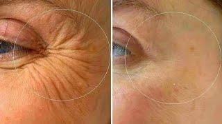 Everyday Eye Wrinkles Massage Crow's Feet 5 Minutes Massage