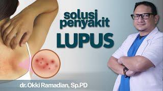 Penyakit Autoimun Lupus yang Punya Banyak Gejala, Ketahui Penyebabnya | Kata Dokter #111