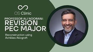 Revision Pec Major Educational Surgical Case Study | Professor Ali Noorani