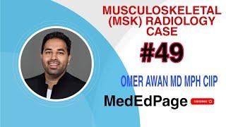 Musculoskeletal (MSK) Radiology CASE #49