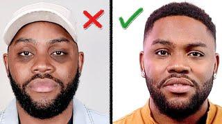 Remove DARK CIRCLES Under Your Eyes (How I Did It) Men's Skin Care