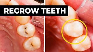 Regrowing vs Remineralizing Tooth Enamel