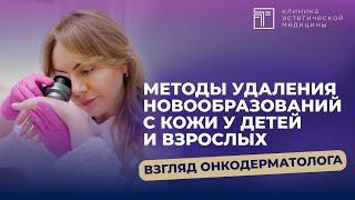 Методы удаления новообразований с кожи у детей и взрослых: взгляд онкодерматолога.