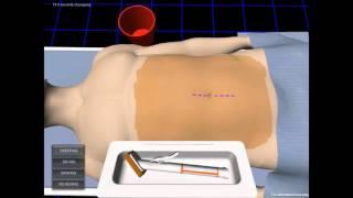 iPad simulation of skin prepping