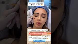 Möhtəşəm endirimlərə hazırsınız? #NigarSultanova #estetik #botox #dolgu