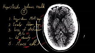 Case #20 (Emergency CT brain course)