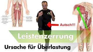 Leisten- & Adduktorenzerrungen | 1 Der Hauptursachen