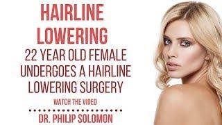 Graphic: Hairline Lowering On 22 Year Old Transgender Patient | Dr. Philip Solomon