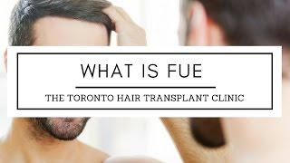 WHAT IS FUE (Follicular Unit Extraction)? | The Toronto Hair Transplant Clinic