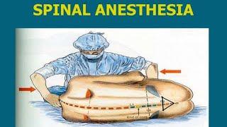 Spinal Anesthesia: Detailed Explanation // How to Give it
