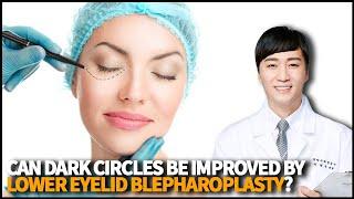 Can dark circles be improved by having Lower Eyelid Blepharoplasty? What is its surgery process?