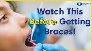 What To Know Before Getting Braces | 8 Tips To Prepare You For Braces