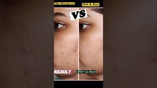 Dot & Key VS The Derma Co || #shorts #comparison #ashortaday #honestreview