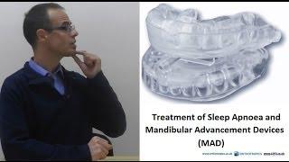 Treatment of Sleep Apnoea by Mandibular Advancement Devices by Dr Mike Mew