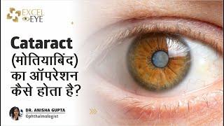 मोतियाबिंद (Cataract) का ऑपरेशन कैसे किया जाता है? | Step-By-Step Explained | Dr Anisha Gupta, Delhi