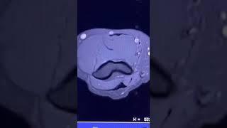 What is an MRI Scan Used For?