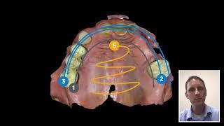 Intraoral scanning technique with Primescan: Scan pattern for best accuracy