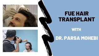 FUE Hair Transplant with Dr. Parsa Mohebi