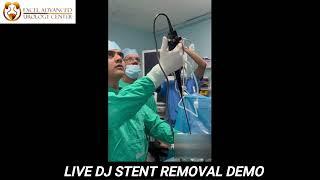 DJ stent removal by flexible cystoscope