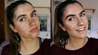 NON-CAKEY Natural Acne Coverage Foundation Routine | DRUGSTORE