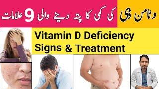 Vitamin D Deficiency Symptoms Test & Treatment Urdu Hindi - Dr Irfan Azeem