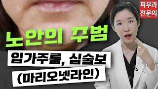 (*Eng) 입가주름, 심술보? 마리오넷 라인 필러로 해결! - 피부과전문의 [닥터필러]