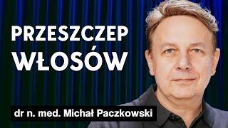 Przeszczep włosów w Polsce: efekty, przyczyny łysienia: Dr Michał Paczkowski | Imponderabilia