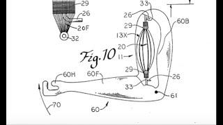 VHS to Digital Video Capture of a 41 Year Old Video of a Robotic Fluid Actuated Muscle Analog