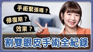 「割雙眼皮」修復期好腫脹？她術後做了關鍵3件事，魅力電眼迅速回歸！ft.陳彥瑋醫師