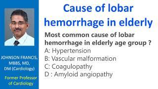 Cause of lobar hemorrhage in elderly