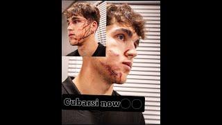 Cubarsi injury update! Pau Cubarsi HORRIFIC HEAD INJURY against Crvena Zvezda |Barca v Crvena Zvezda