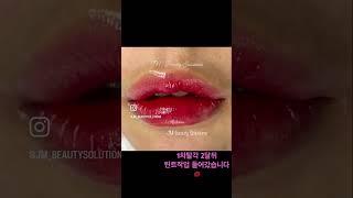 1차탈각후 틴트리터치 작업 #jmbeautysolutions #jm뷰티솔루션스 #제이엠뷰티솔루션스 #반영구 #입술반영구 #틴트입술 #permanentmakeup