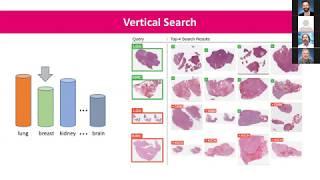 Image Search for Pan-Cancer Diagnostic Consensus - Dell Technologies Virtual HIMSS20 Webinar