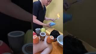 Cupping Therapy At Ut Spa Hoi An