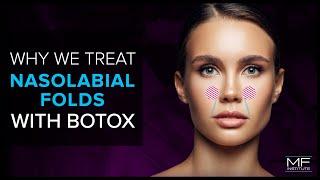 Using BOTOX® To Treat Nasolabial Folds at Mabrie Facial Institute