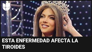 Miss Universo Ecuador revela que padece una enfermedad sin cura: te contamos cuál es y los síntomas