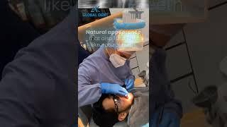 Replacing missing tooth | Invisalign Providers and Orthodontists | AK Global Dent | Learn More