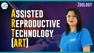 Assisted Reproductive Technologies (ART) || #NEET Zoology || #ShortLecture || Infinity Learn NEET