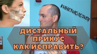 Дистальный прикус и его коррекция. Неправильный прикус