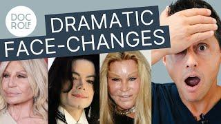 DRAMATISCHE VERÄNDERUNGEN: Jocelyn Wildenstein, Michael Jackson & Donatella Versace!!