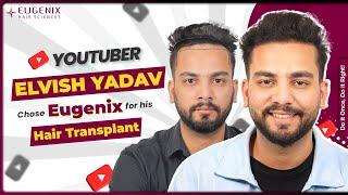 YouTuber Elvish Yadav’s Hair Transplant Journey & Transformation - Before & After Results