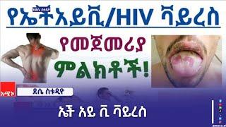 "የምርመራ አቅምን በማሳደግ እና የግንዛቤ ፈጠራ ሥራን በማጠናከር የኤች አይ ቪ ቫይረስ ሥርጭትን ለመግታት እየተሠራ ነው" የደቡብ ወሎ ዞን ጤና መምሪያ