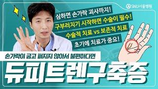 손가락이 펴지지 않는다면 #듀피트렌구축증이라던데... 이름은 복잡하지만 쉽게 설명해드립니다!  #SNU서울병원 #수부전문의 #곽상호원장 #듀피트렌구축증