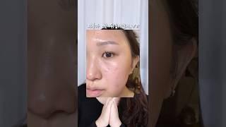 스팟 케어 이제 짜거나 바르지 말고 붙이세요!! 올리브영 패치 추천 #kbeauty #skincare #shorts