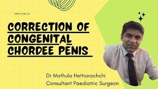 Correction of the congenital chordee penis: Dr Mathula Hettiarachchi.