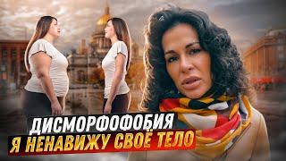 ДИСМОРФОФОБИЯ! Как избавиться? / Совет психолога, Анна Дроздецкая