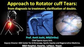 General Principles of rotator cuff tear