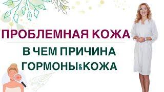 ️ ПРОБЛЕМЫ С КОЖЕЙ, В ЧЕМ ПРИЧИНАГОРМОНЫ, ПИТАНИЕ И КОЖА Врач эндокринолог, диетолог Ольга Павлова