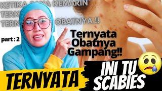 Intan Vlog #79 - Obat Scabies - WASPADA Ini Bisa MENULAR !!! / Ternyata Cuman pake INI..!!