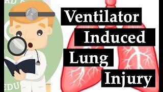 Mechanical Ventilation Basics - Ventilator Induced Lung Injury (VILI) | Clinical Medicine